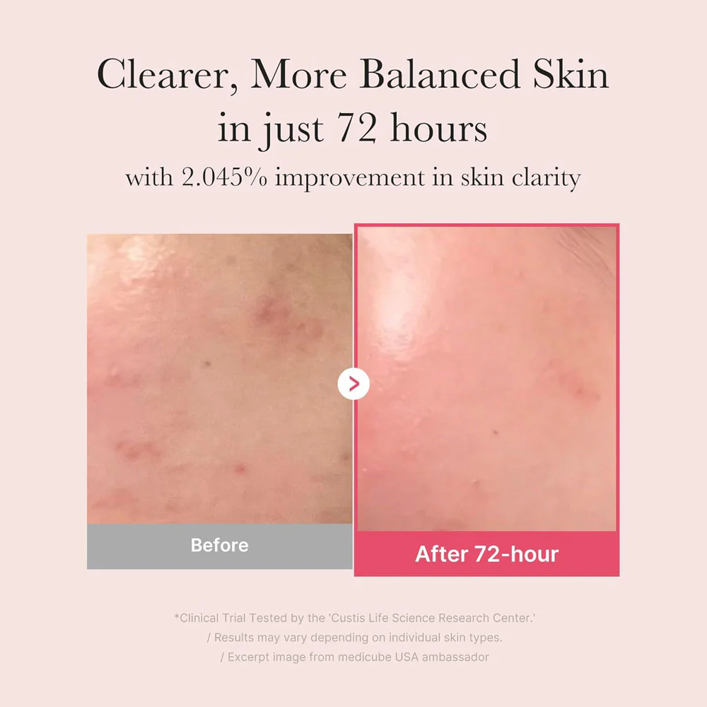 Medicube TXA Niacinamide 15 Serum 30ml - Image 3